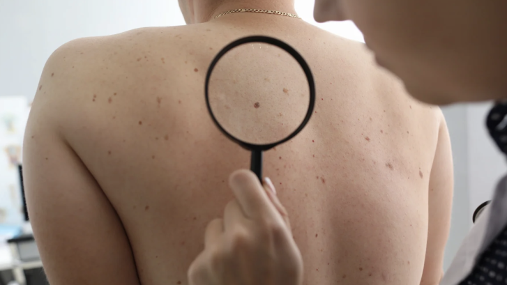 same-day dermatology appointments in Prince Frederick MD